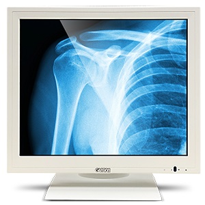 GVision MA19BH-AB-1690 Medical Touch Screen Monitor, Resistive Touch, 400nits, Medical White